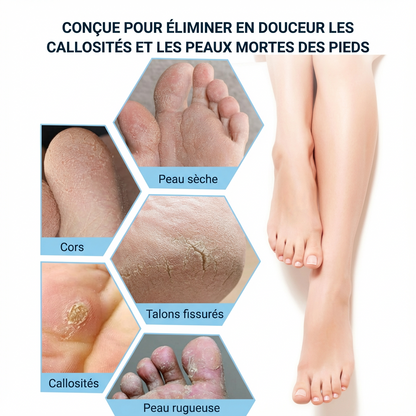 Cleanfeet® Râpe à pieds élimine les callosités des pieds